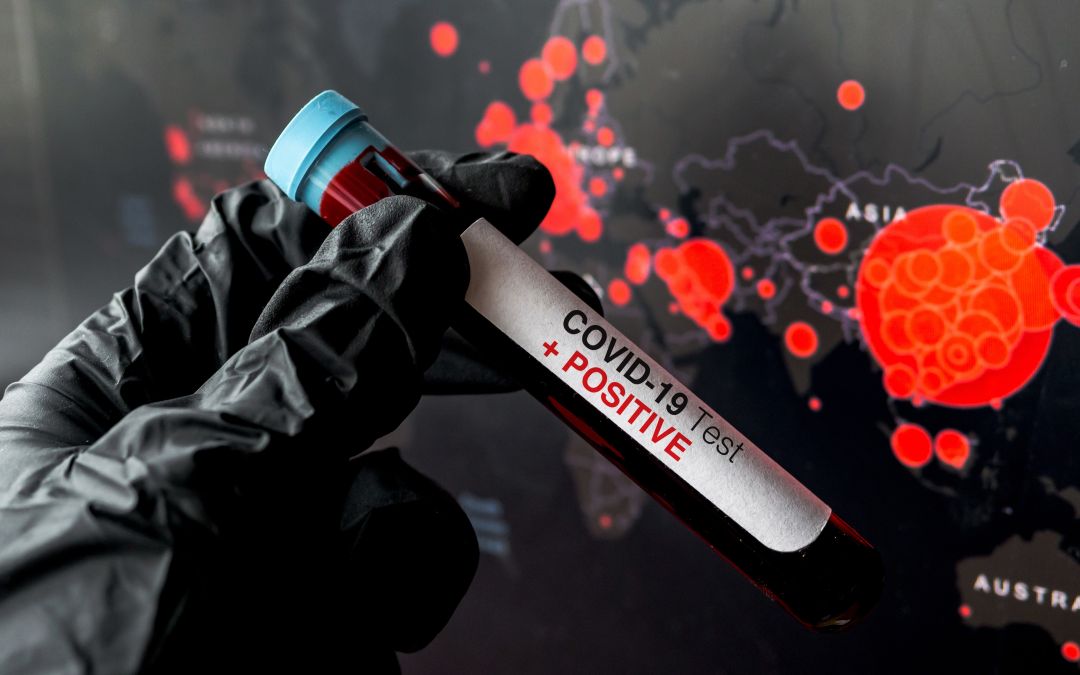 testy na koronawirusa