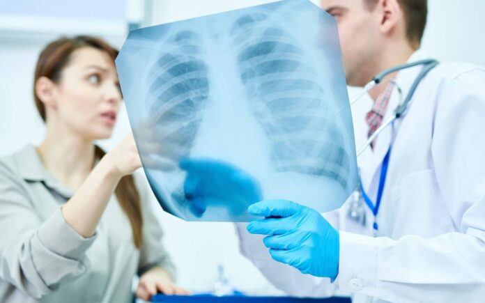 lekarz omawia rtg płuc