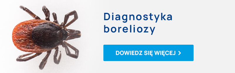diagnostyka boreliozy mobile
