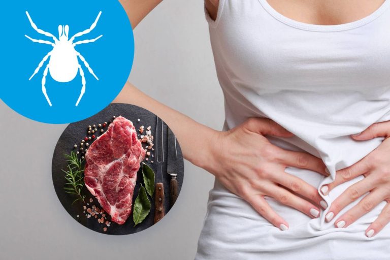 Ukąszenie przez kleszcza i alergia na czerwone mięso – co mają ze sobą wspólnego?