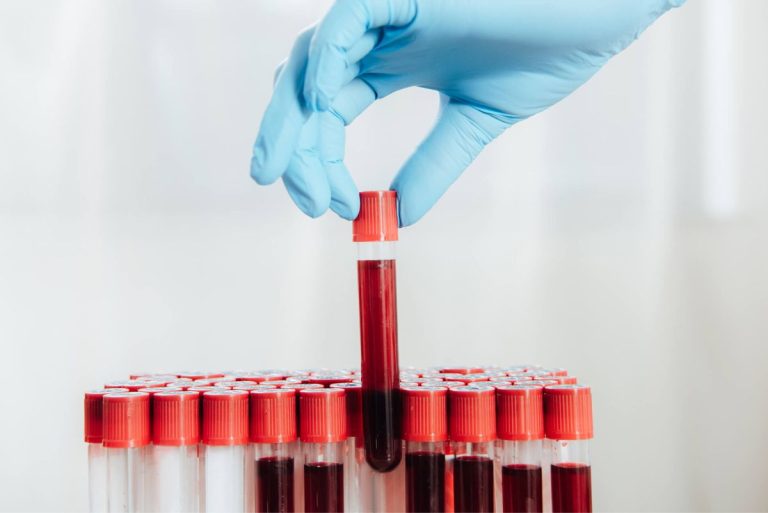 Morfologia krwi – badanie, które może uratować życie!
