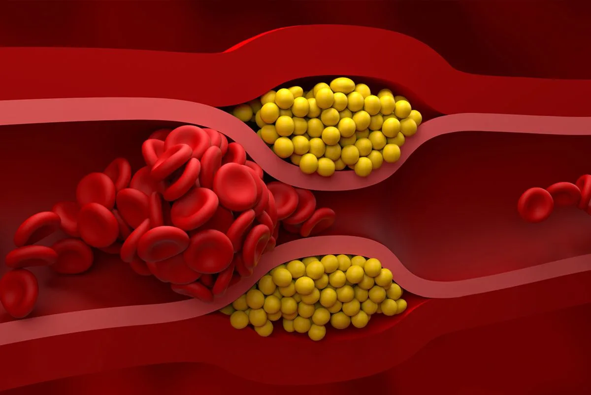 Cholesterol Nie Hdl Kiedy Jak I Dlaczego Zbadać Jego Poziom 8838