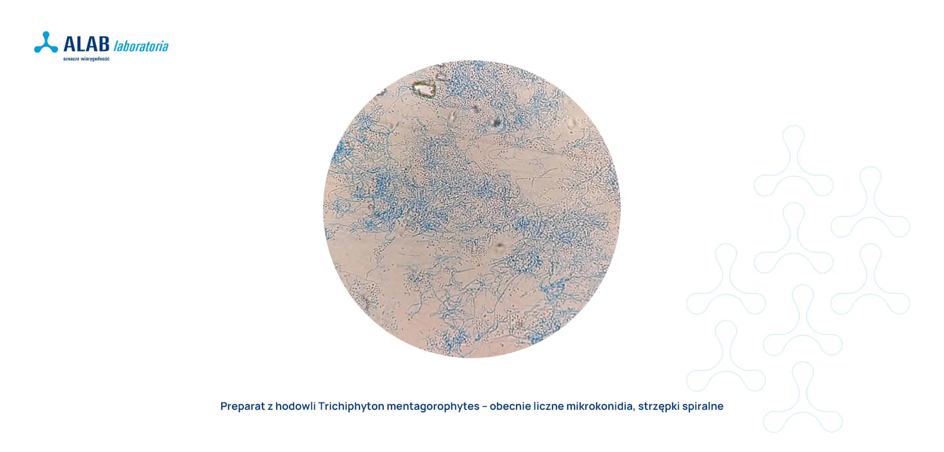 grzyb trichiphyton mentagorophytes pod mikroskopem