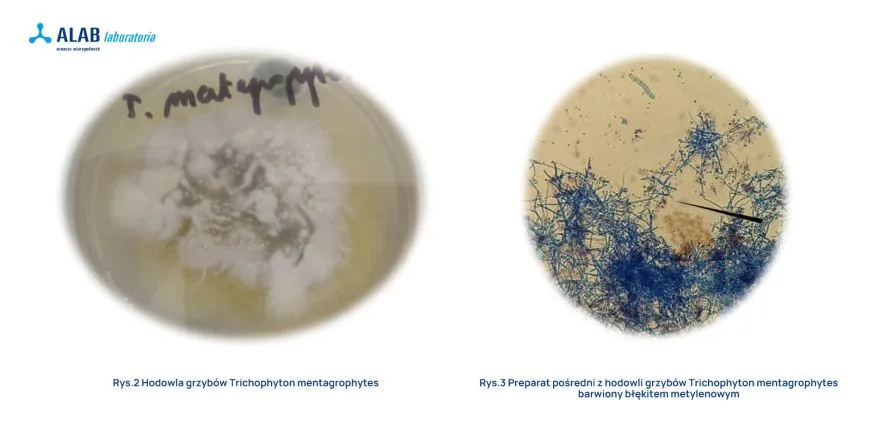 grzyby Trichophyton mentagrophytes pod mikroskopem 