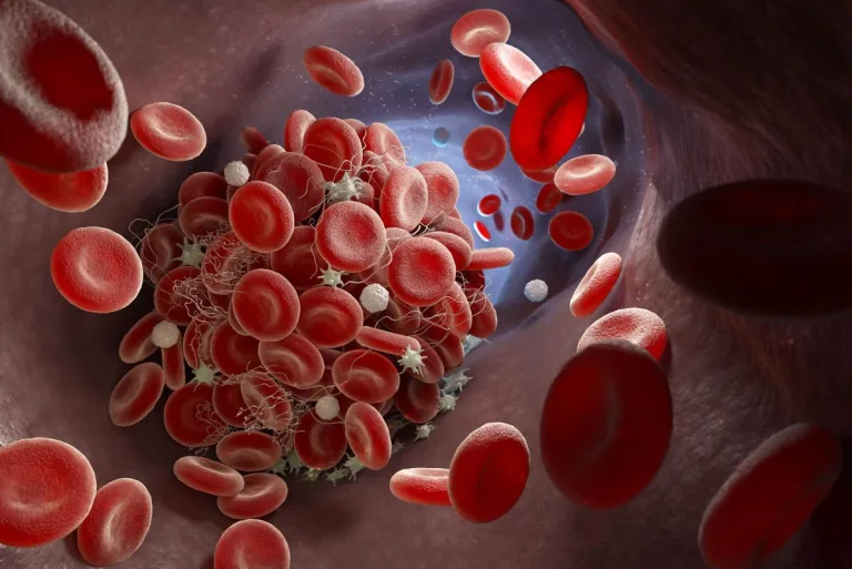 Stan zapalny i rola leukocytów
