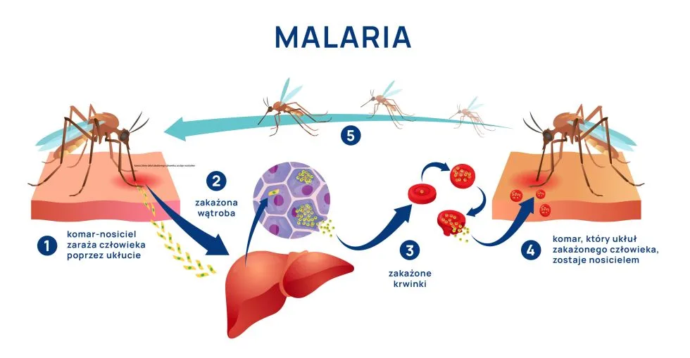 malaria - sposób zakażenia i rozwój choroby, cykl życiowy zarodźca malarii infografika