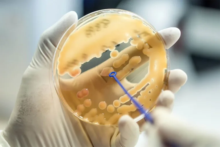 Badanie mikrobiologiczne – czym jest i dlaczego warto je wykonać?