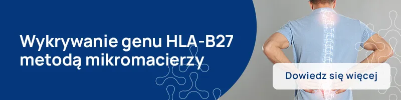 wykrywanie genu HLA-B27
