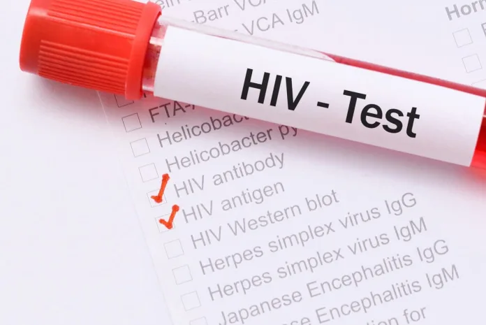 testy w kierunku HIV