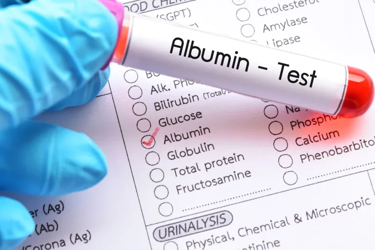 Co to są albuminy i w jakim celu bada się ich poziom?