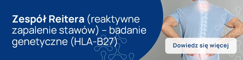 Zespół Reitera (reaktywne zapalenie stawów) – badanie genetyczne (HLA-B27)