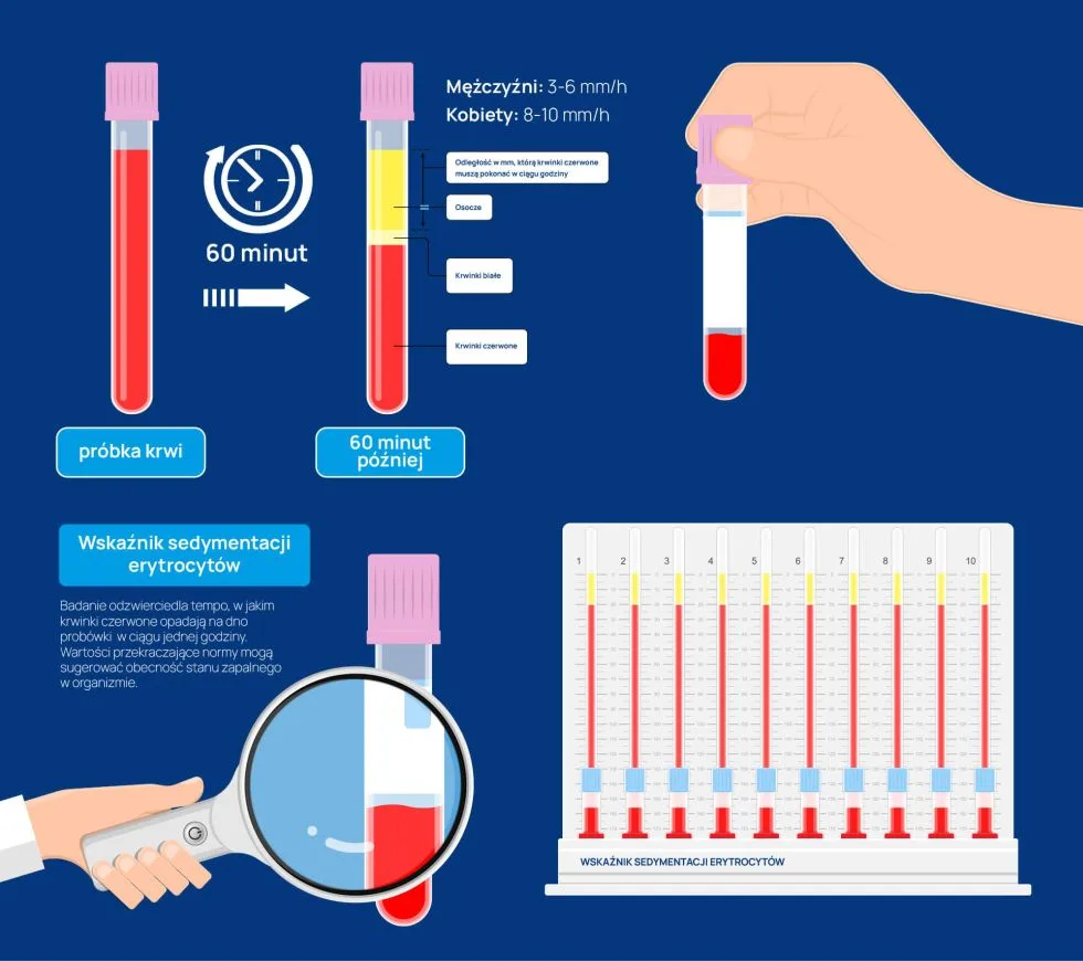 OB infografika odczyn Biernackiego